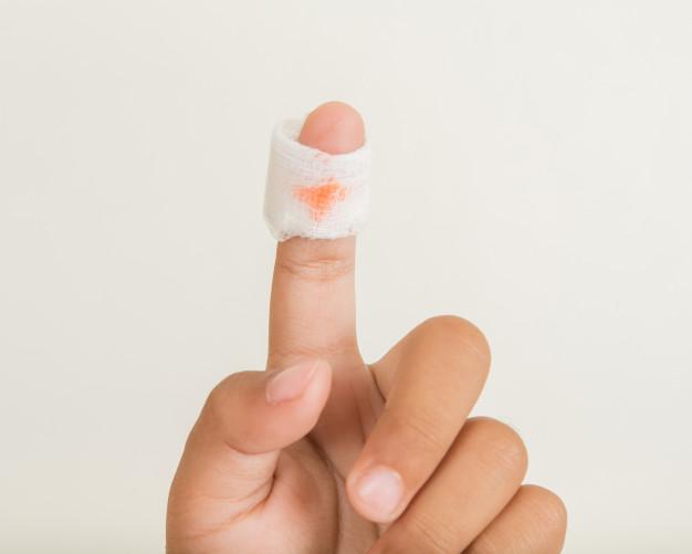 finger bite