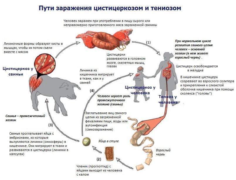 bệnh cysticercosis của gia súc